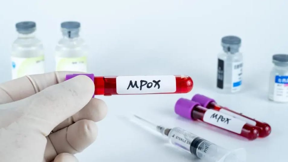 Variole du singe – Mpox: le système de santé français placé en « état de vigilance maximale »