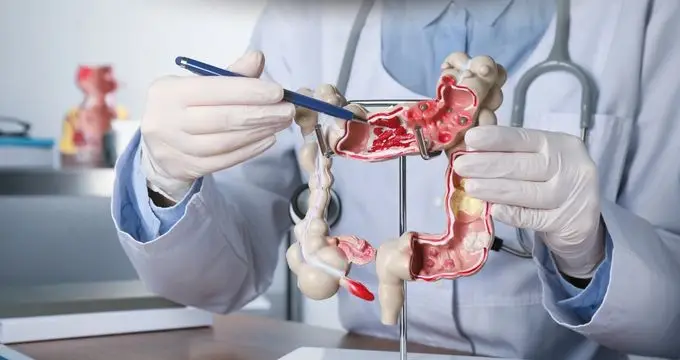 Le COLON TOUR fait escale à Sète dans l'Hérault - photo d'illustration INFOCCITANIE